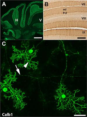 Overexpression of Human SOD1 Leads to Discrete Defects in the Cerebellar Architecture in the Mouse